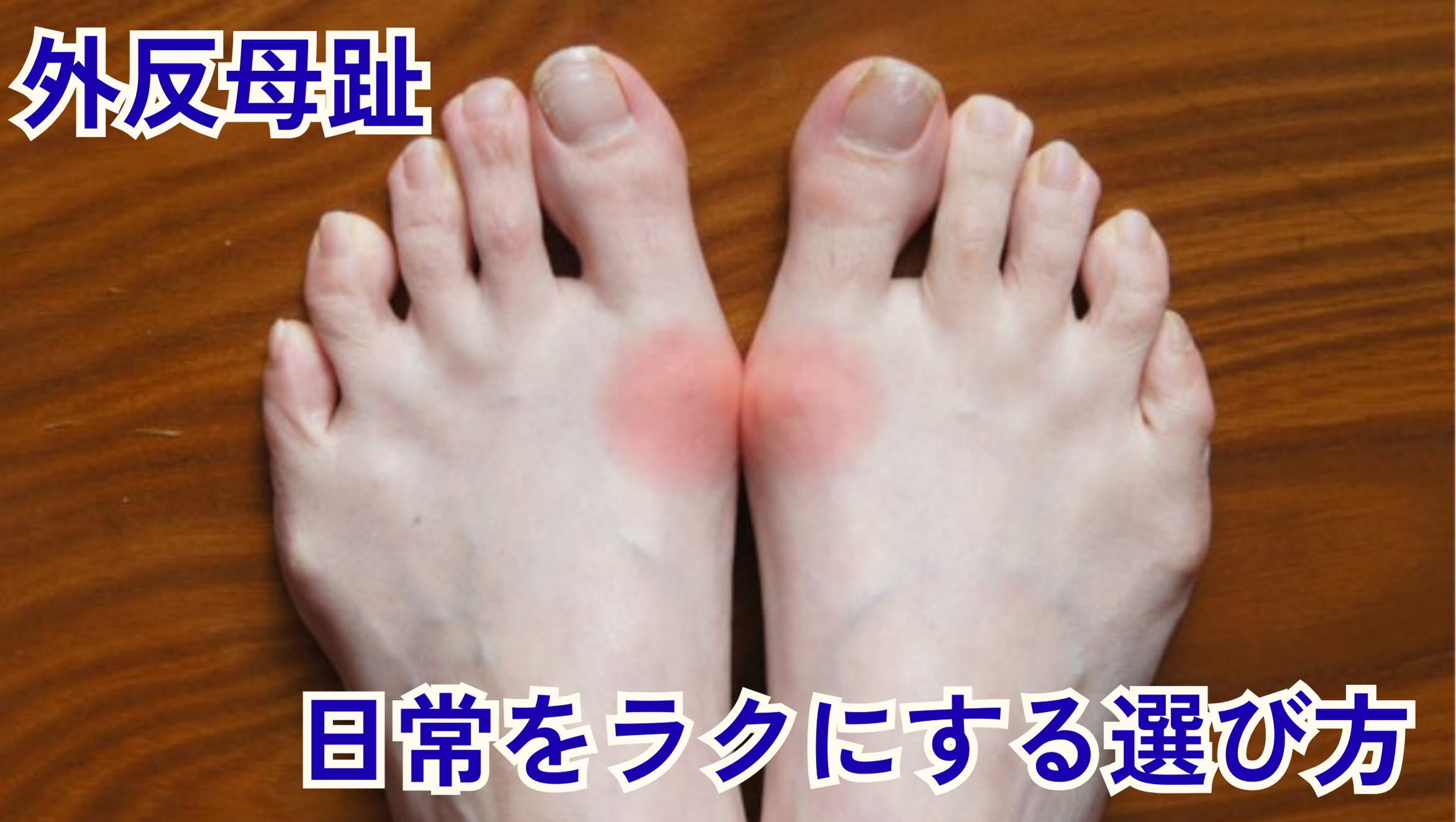 外反母趾で親指が痛い…薄手サポーターで"日常の一歩"をラクにする選び方